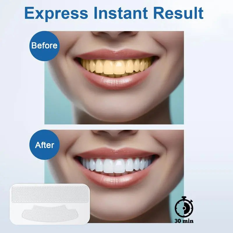 Mysmile Teeth Whitening Strip(6% HP) W/ 28X LED Light (1Pcs Light + 14Sets Strips) Oral Tooth Whitening - Moon White