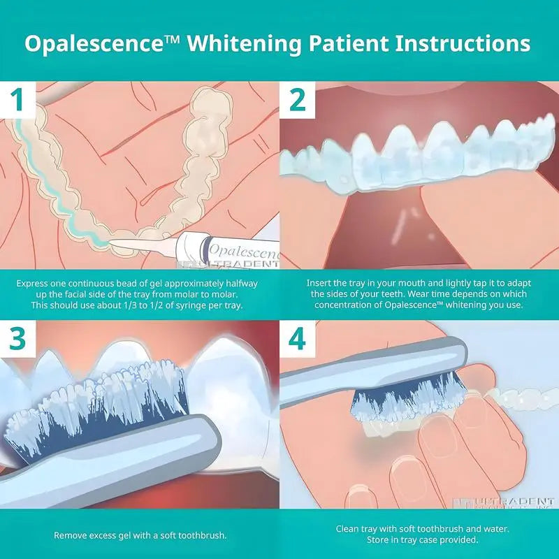 Opalescence 10% Teeth Whitening Kit - Gel Syringes Refills - Low Sensitivity - Moon White
