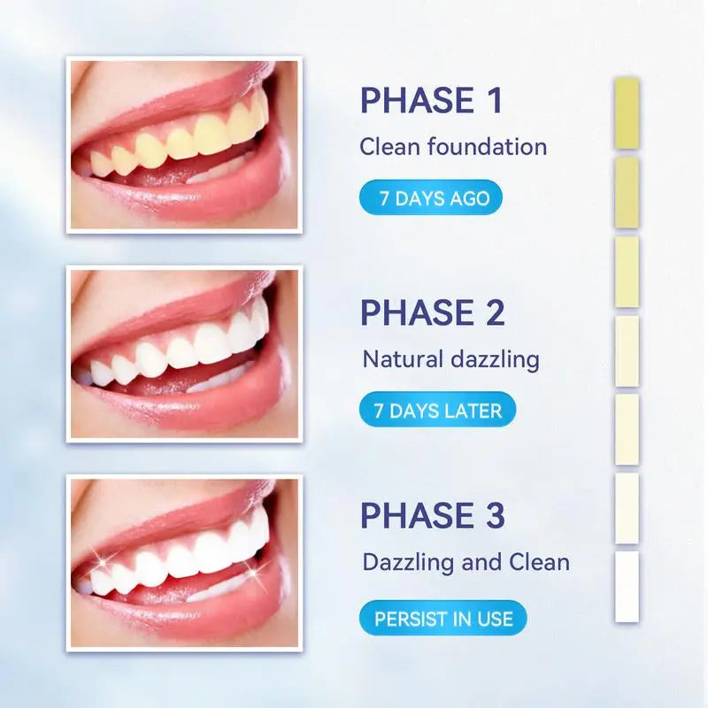 Somall Teeth Whitening Gel Somall Teeth Whitening LED Accelerator Light Kit, More Dentist Recommended Professional Teeth Whitening Kit - Mild and Insensitive Fast Teeth Whitening Agent - Enhances Long-Lasting Whitening - Moon White