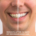 Teeth Whitening Pen - Moon White
