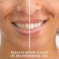 Teeth Whitening Pen - Moon White