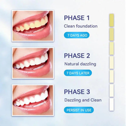 Somall Teeth Whitening Gel Somall Teeth Whitening LED Accelerator Light Kit, More Dentist Recommended Professional Teeth Whitening Kit - Mild and Insensitive Fast Teeth Whitening Agent - Enhances Long-Lasting Whitening - Moon White